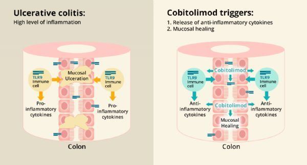 cobitolimod cobitolimod